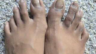Wanna Suck My Nasty Toes Before My Pedicure?? These Corns Make A Great Tongue Scraper!