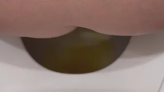 Kennedys Toilet