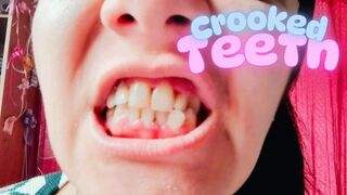 Cleaning my crooked teeth
