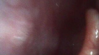 Katja Endoscopic Mouth Tour