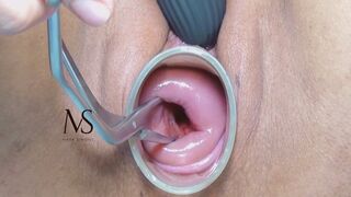 MASTURBATION OF MY OPEN-MOUTHED CERVIX 4k