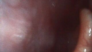 Katja Endoscopic Mouth Tour!