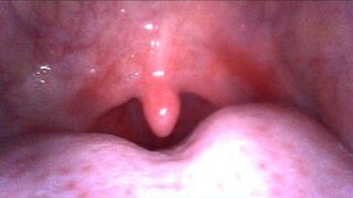 Kimmys Endoscope Mouth Tour