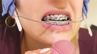 Braces HEADGEAR FUN & CUM