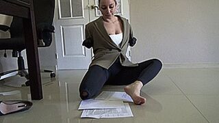 amputated body parts m