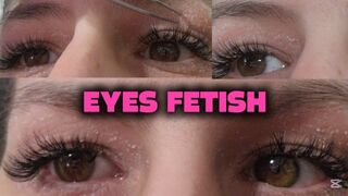 Long Lashes, Itchy Eyes and Skin Picking with a Tweezer