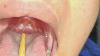 "Close-Up of My Uvula"