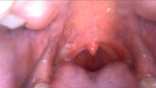 Giantess Kimmy Mouth Endoscope