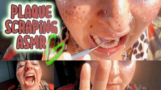 ASMR Dental Fun Taboo: Plaque Scraping, ASMR Teeth Cleaning in Sunlight | Natural Sounds + Up-Close Plaque Removal (BBW Freckled Goddess)