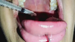 Feeding myself milk with a syringe - Close-Up - Uvula Fetish