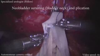 Tiny robot arms touching my guts