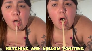 Yellow vomit