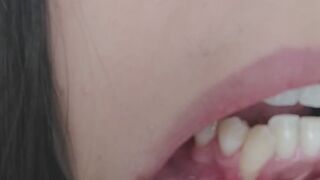 Look closely inside my mouth