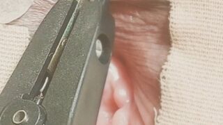 Needling to the clitoris.