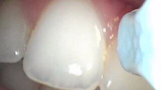 POV Fantasy: You’re the Floss in Her 20-Year-Old Mouth