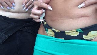 Scar below the fat belly d