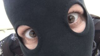 I scratch my legs and butt b