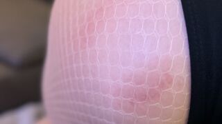 Open Wide: The Patient Who Couldn't Stop Biting, Mouth Fetish, Biting Fetish, Finger Fetish