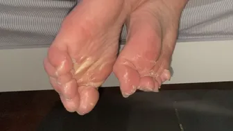 Dpfeet