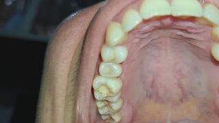 Close-Up Smile.
