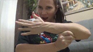 Veins on my arms and legs hl