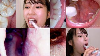 Mino ri Mashiro - Observing Mino ri's teeth, mouth, and back of the throat with a dental camera - MOV