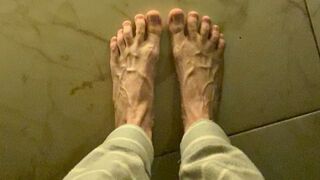 Swollen veins on the feet