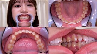 Mai Onodera - Watching Inside mouth of Japanese cute girl - MOV