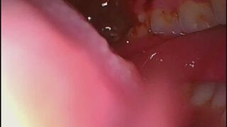 Borescope inside chewing biting teeth at work
