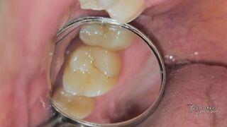 THE DENTIST PT1