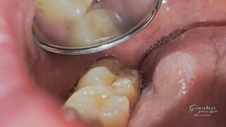THE DENTIST PT 01