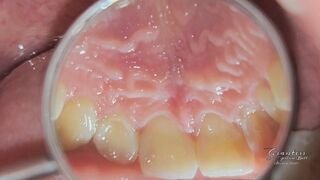 AT THE DENTIST PT 1