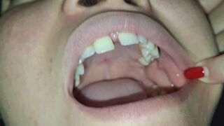 Yellow Teeth Close-Up: Placer Visual Prohibido