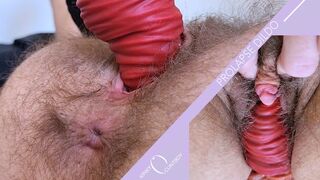 Anal Prolapse Dildo Fucks Hairy Ftm Pussy (WMV)