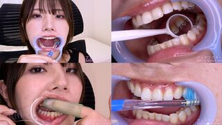 Haruna Kawai - Observing Haruna's teeth with a dental mirror & brushing her teeth while wearing a mouth opener & finger toothbrushing while wearing a lip hook - MOV