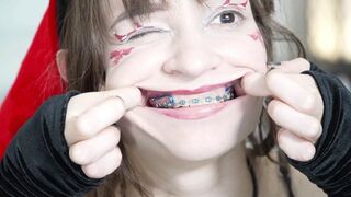 Christmas Girl Showing Her Braces Close