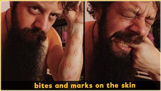 Bites and marks on the skin | Full HD 1080p | Self Biting - vore