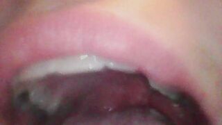 Endo Slober Fun