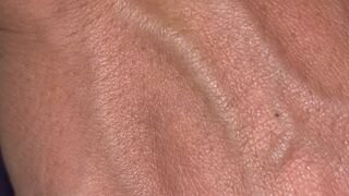 Veins Exposed: Side Two