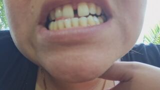 My yellow teeth dominate you