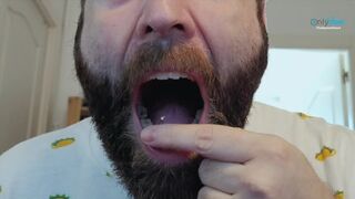 El hombre que comía hombres Vore