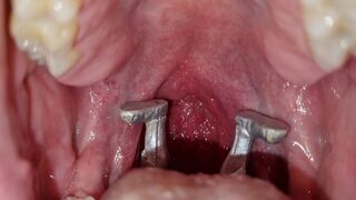 The male giant wants to swallow his two shrunken mates