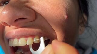 Mis dientes estan amarillos & llenos de comida