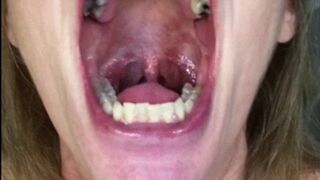 IS THERE A DENTIST AROUND?
