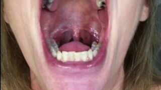 IS THERE A DENTIST IN THE HOUSE?