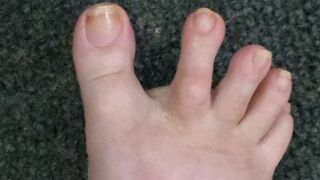 Longing for long toe wiggles with mixed in cracks?
