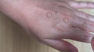 Clean hands