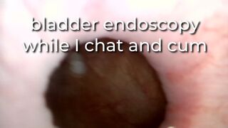 bladder endoscopy while I chat and cum
