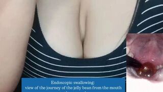 Endoscopic swallowing: view of the journey of the jelly bean from the mouth to the stomach