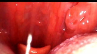 Oral and deep examination with endoscopic view (20 minutes)